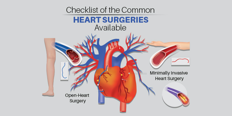 Checklist Of The Common Heart Surgeries Available