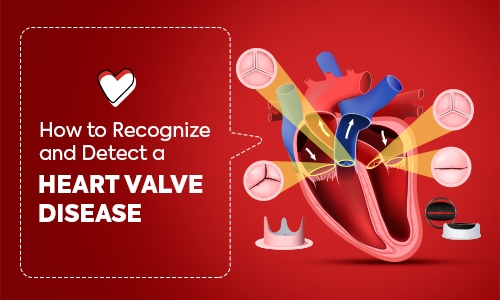 How to Recognize and Detect a Heart Valve Disease