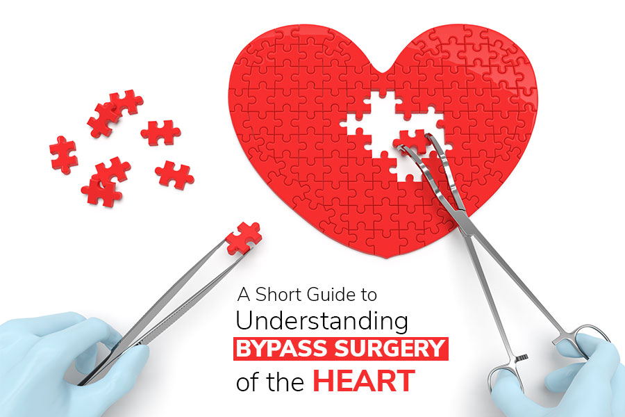 A Short Guide to Understanding Bypass Surgery of the Heart